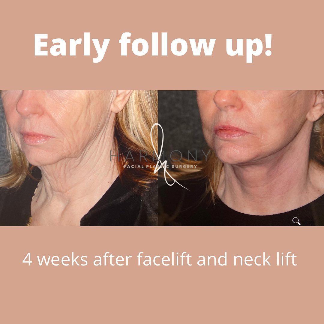 Harmony Facial Plastic Surgery